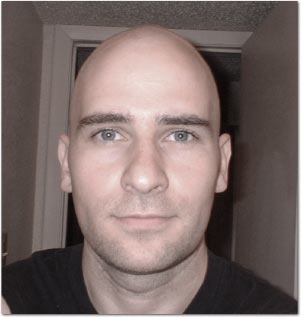 Intentionally Bald